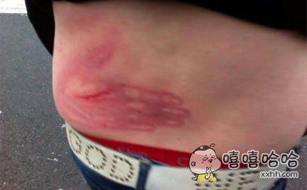 这练过铁砂掌吧。够狠